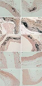 Advantage of Vitamin K2 Over K1