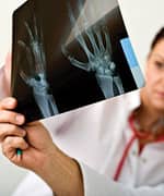 UC-II® Induces Specific Oral Tolerance, Provides Powerful Joint Protection