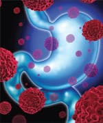 The Powerful Role Of Probiotics In Cancer Prevention