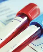 Ranges Of LDL Levels And Impact On Risk