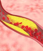 Safely Control Cholesterol