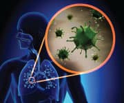 When Influenza Turns Deadly