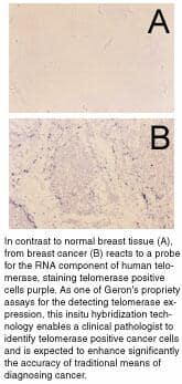 Breast Tissue