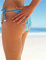 A Scientific Solution to Unsightly Cellulite