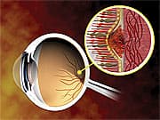 The Anatomy of Macular Degeneration