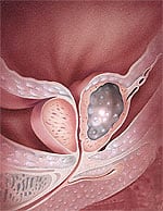 The New England Journal of Medicine