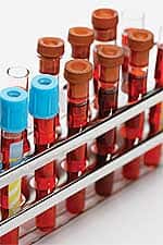 Flawed Study May Kill Millions