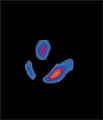 Forging New Pathways—Repairing the Heart’s Blood Supply