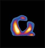 A Bridge to Self-Sustaining Therapy