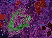 Boosting Mitochondrial Health