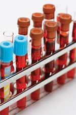 Zinc Helps Protect Against Pneumonia