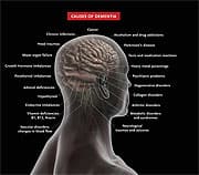 Zero to 100 in 100 Milliseconds