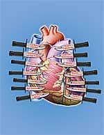 The Vytorin®-Simvastatin Study