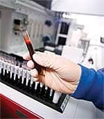 New Studies Confirm Lethal Effects of Elevated C-Reactive Protein