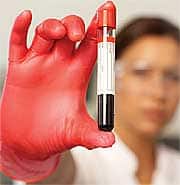 The Most Important Tool for Disease Prevention