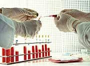 Measuring Glycation Reactions in your Body