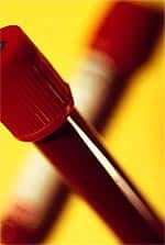 Estrogen’s Role in Benign Prostate Enlargement