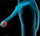 Cancer-Preventive Potential of Vitamin D