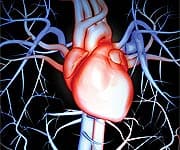 A Hidden Cause of Heart Attack and Stroke