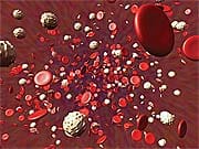 Common Sense Approaches to Heart Attack Prevention