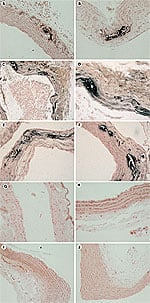 Advantage of Vitamin K2 Over K1