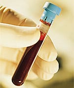 What You Need to Know: Using Blood Test Findings to Safely Induce Weight Loss