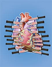 No More Heart Attacks!