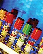 Fighting Cancer Metastasis and Heavy Metal Toxicities With Modified Citrus Pectin