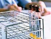 ... diabetes is significantly more prevalent in people with low serum levels of vitamin D