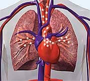 New Benefits of Omega-3 Fatty Acids