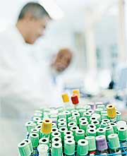 Higher Vitamin D Levels Associated With Speedier Brain Processing