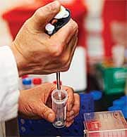 High Folate Levels Could Help Prevent Allergic Reactions and Reduce Symptoms