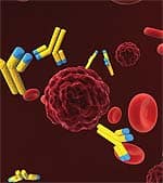 Predicting Who Will Benefit from Prostate Cancer Surgery