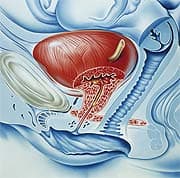 Halt the Cycle of Urinary Tract Infections