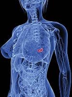 Dr. Gofman Explained How X-rays Cause Atherosclerosis