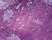 7 Interventions to Heal and Protect Your Liver