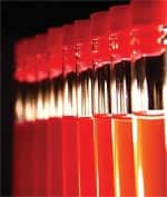 A Fundamental Lack of Understanding of Endothelial Dysfunction