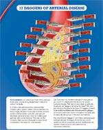 17 Daggers Arterial Disease