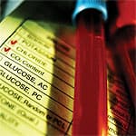 Excess Vitamin A Can Thwart Vitamin D