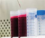 Poison Control Statistics Prove Supplements’ Safety