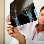Clinical Breakthroughs in Natural Arthritis Relief