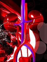 Innovative Strategies to Combat Kidney Disease