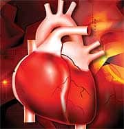 Coronary Artery Disease Can Be Reverse