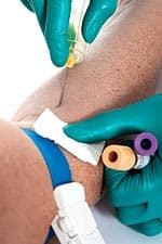 Impede Sugar Absorption 