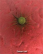 The UCSF Study of Lenalidomide and Aging