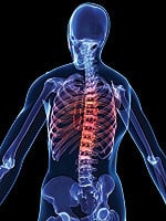 Gastric Bypass: Free Pass? Not for Your Bones