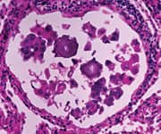 Photomicrograph of the lung