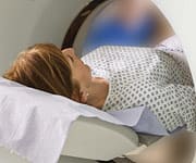 How Radiation Causes Long-term Damage to Breast Tissues