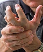 Chondroitin Sulfate Improves Hand Arthritis in Clinical Trial