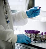 Stem Cell Transplantation